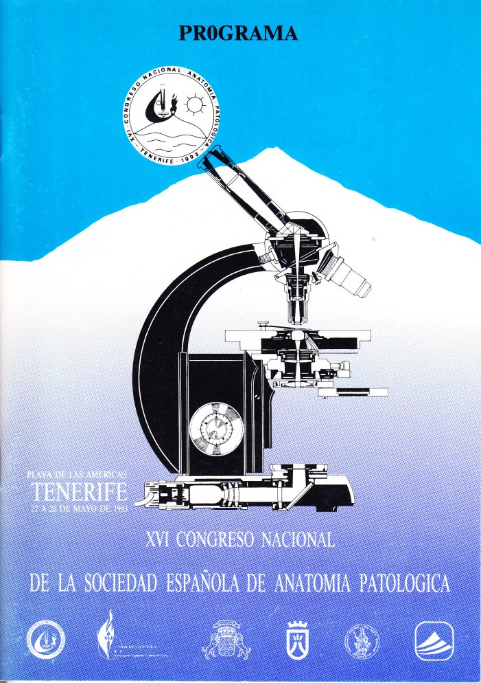 1993 Tenerife