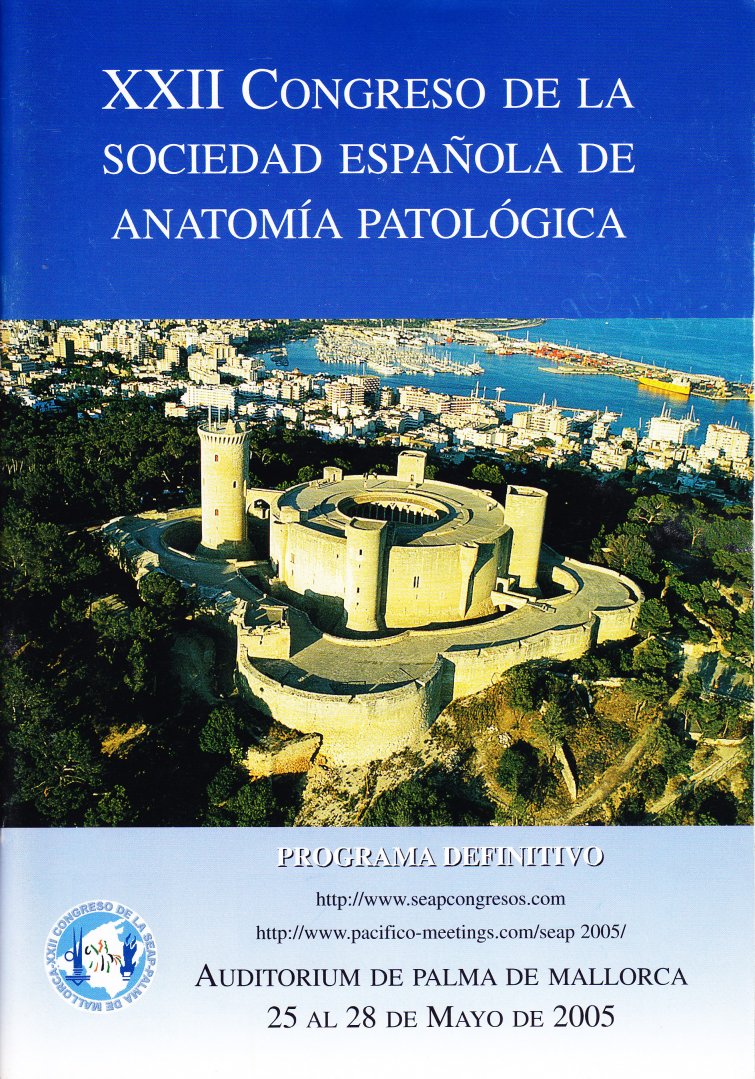 2005 Palma