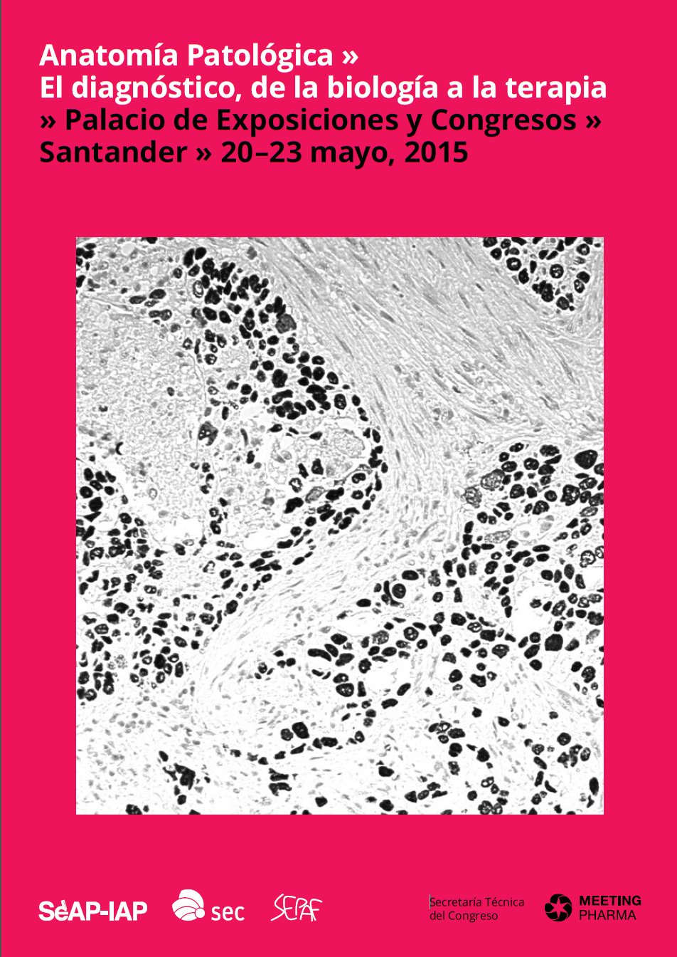 2015 Santander